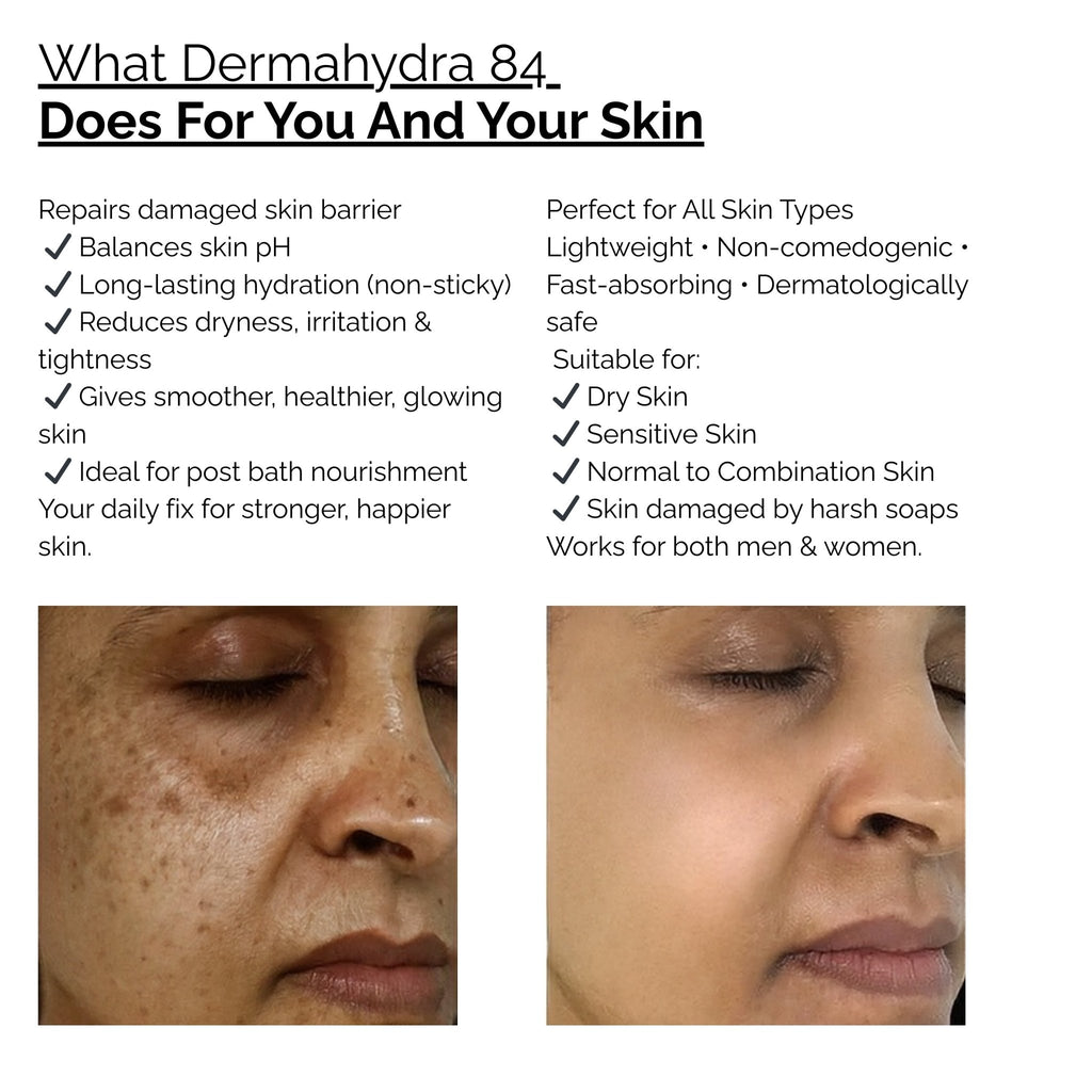 Skinziya Dermahydra 84 Moisturizer – Deep Hydration & Skin Barrier Repair - Skinziya