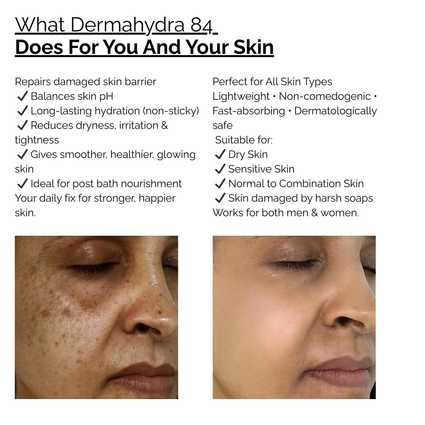 Skinziya Dermahydra 84 Moisturizer – Deep Hydration & Skin Barrier Repair - Skinziya