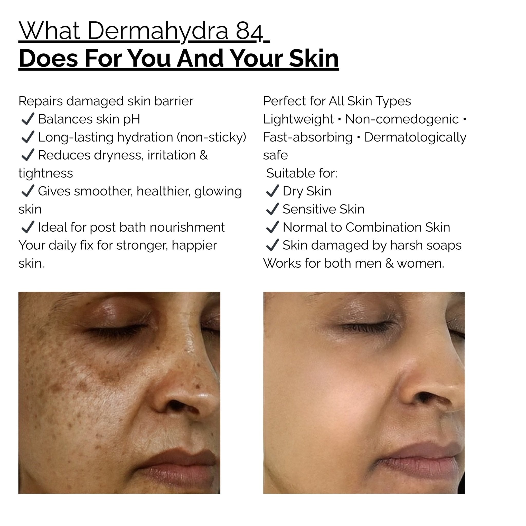 Skinziya Dermahydra 84 Moisturizer – Deep Hydration & Skin Barrier Repair - Skinziya