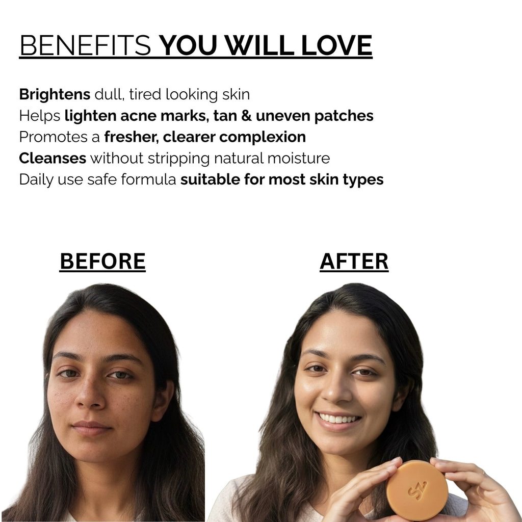 Skinziya Glowjic Kojic Acid Soap – Skin Brightening & Dark Spot Care - Skinziya