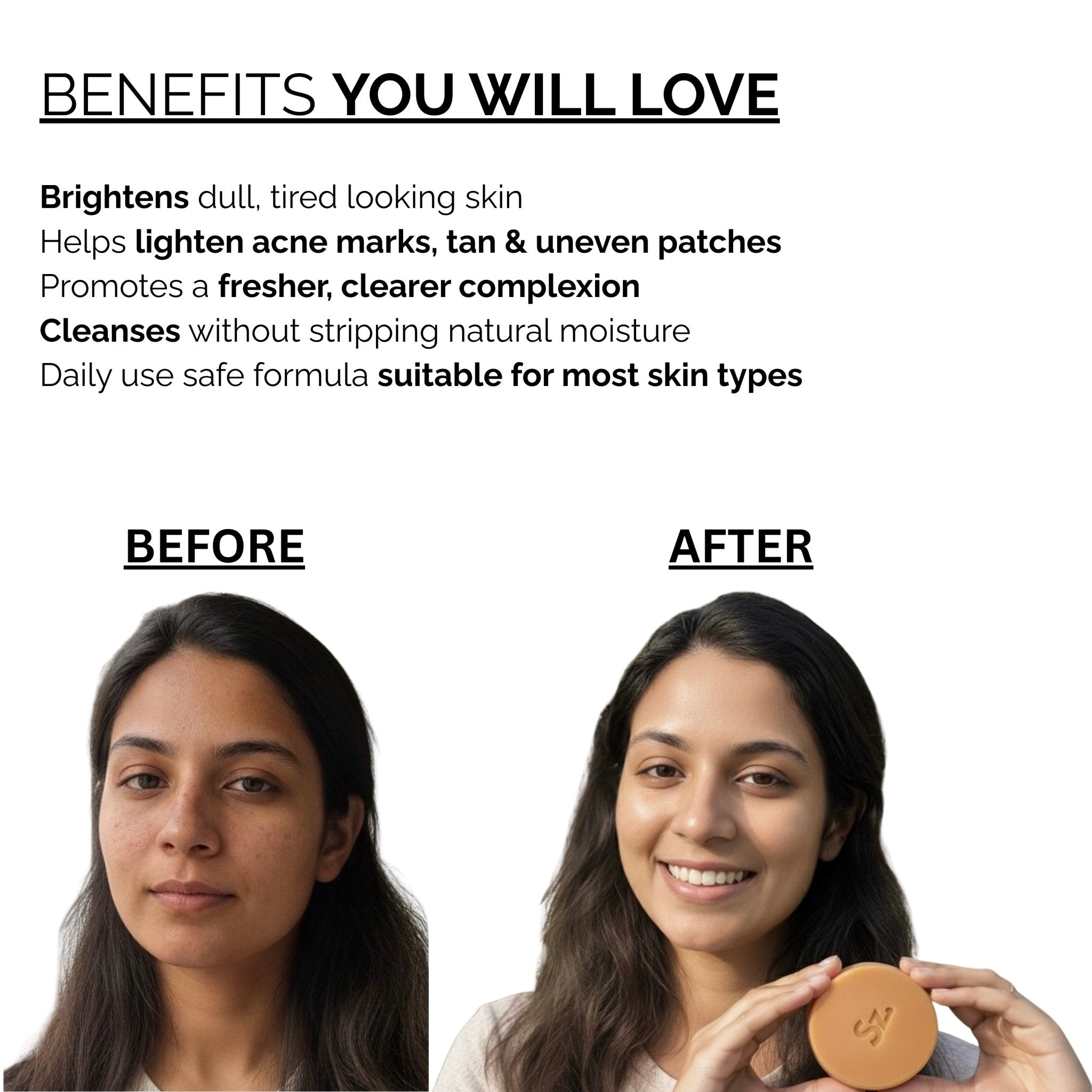 Skinziya Glowjic Kojic Acid Soap – Skin Brightening & Dark Spot Care - Skinziya