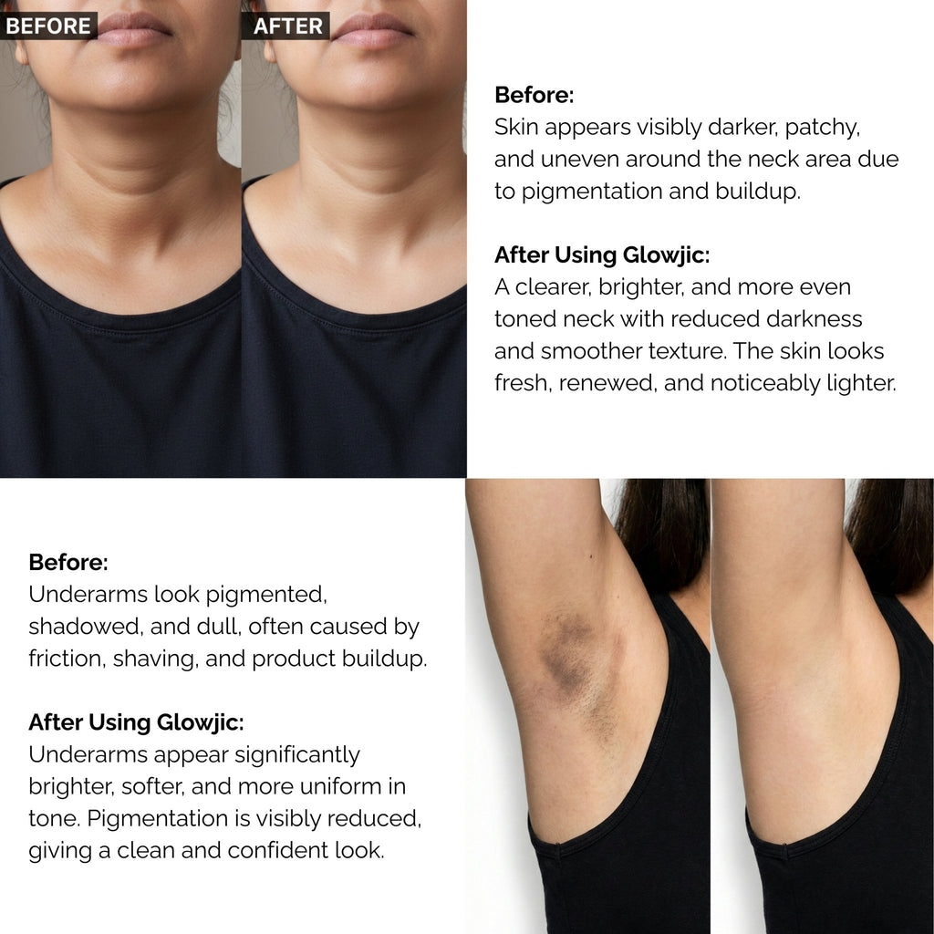 Skinziya Glowjic Kojic Acid Soap – Skin Brightening & Dark Spot Care - Skinziya