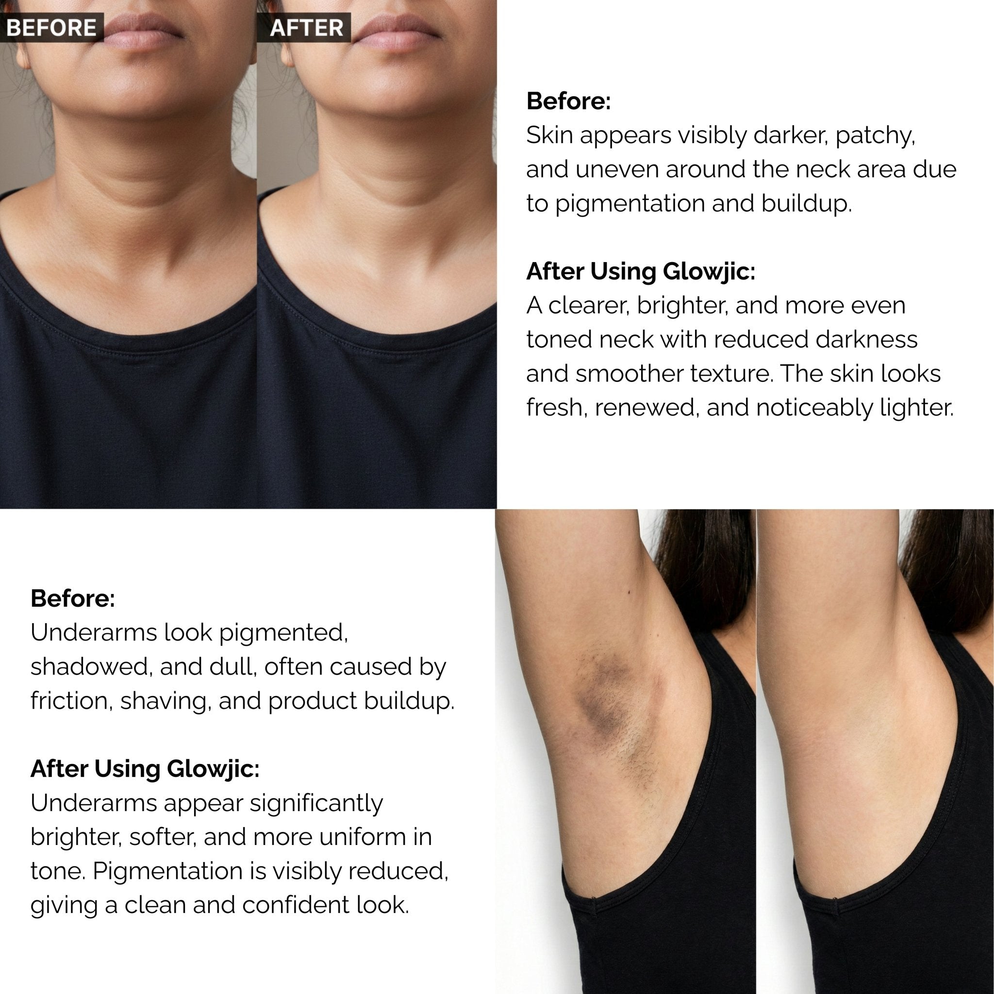 Skinziya Glowjic Kojic Acid Soap – Skin Brightening & Dark Spot Care - Skinziya