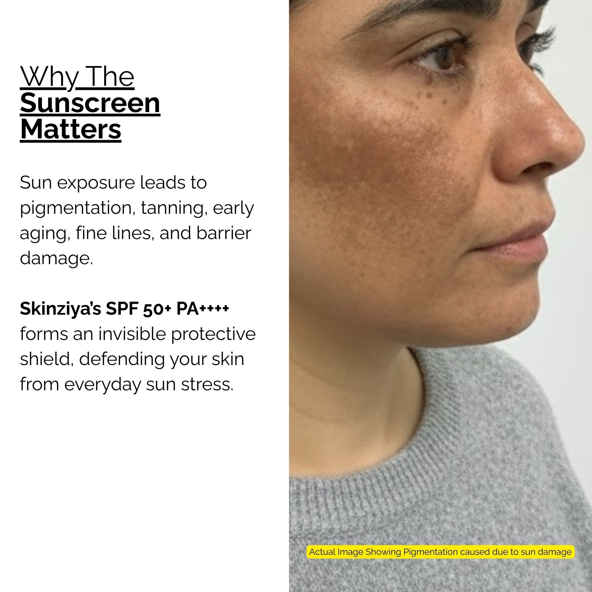 Skinziya SPF 50+ PA++++ Sunscreen – Broad Spectrum UVA/UVB Protection - Skinziya