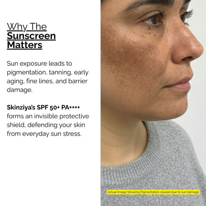 Skinziya SPF 50+ PA++++ Sunscreen – Broad Spectrum UVA/UVB Protection - Skinziya