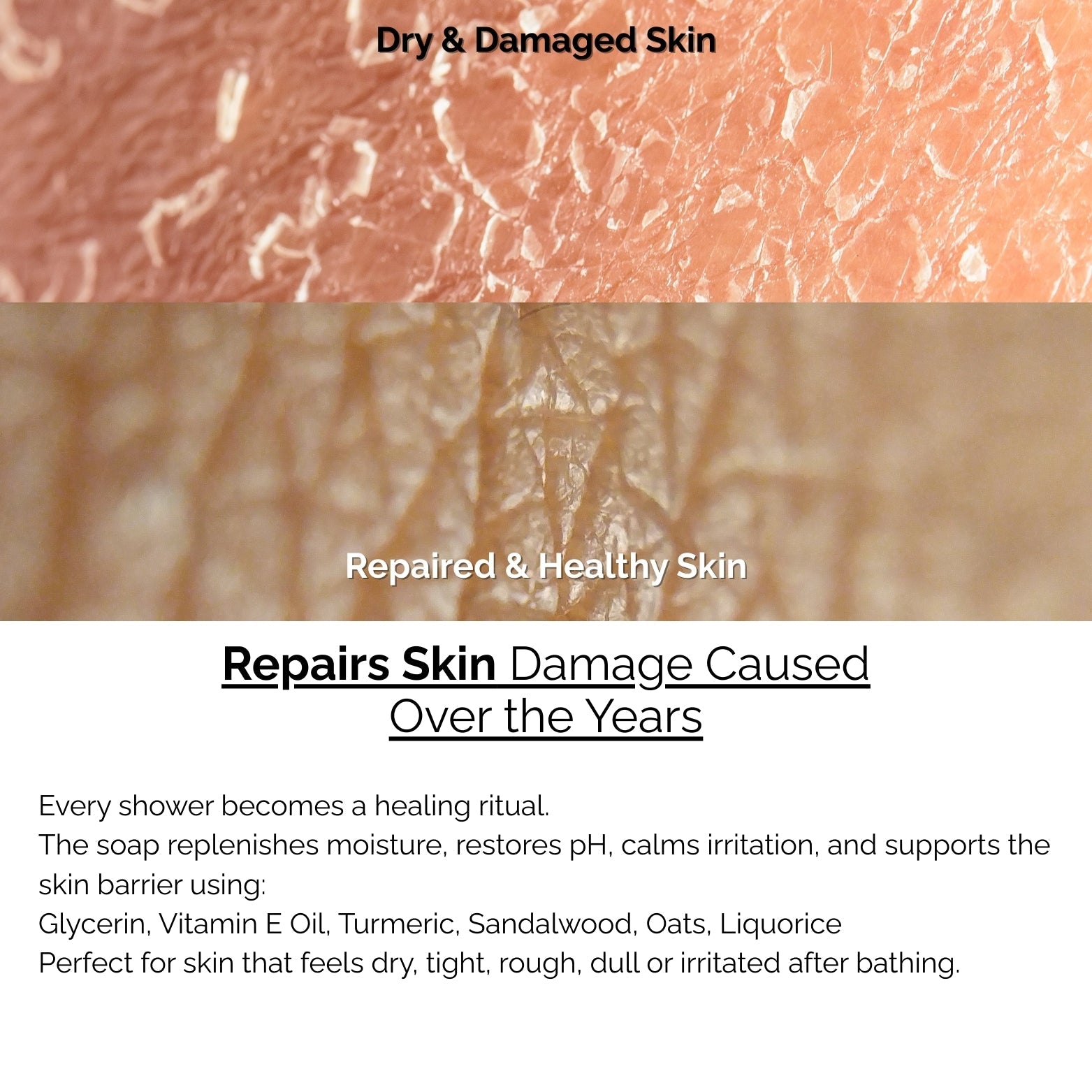 Skinziya Ubtan Herbal Brightening Bath Soap – Turmeric & Sandalwood - Skinziya