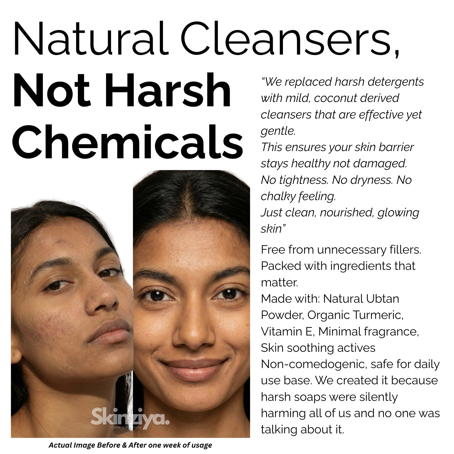 Skinziya Ubtan Herbal Brightening Bath Soap – Turmeric & Sandalwood - Skinziya