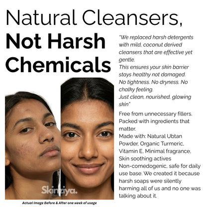 Skinziya Ubtan Herbal Brightening Bath Soap – Turmeric & Sandalwood - Skinziya